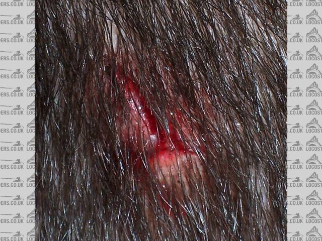 head wound